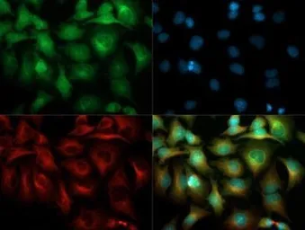Anti-VEGF Receptor 1 antibody used in Immunocytochemistry/ Immunofluorescence (ICC/IF). GTX30653