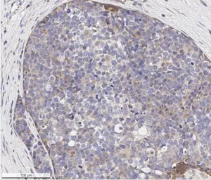 Anti-VEGF Receptor 1 antibody used in IHC (Paraffin sections) (IHC-P). GTX30653