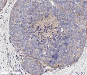 Anti-VEGF Receptor 1 antibody used in IHC (Paraffin sections) (IHC-P). GTX30653