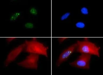 Anti-53BP1 antibody used in Immunocytochemistry/ Immunofluorescence (ICC/IF). GTX30658