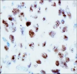 Anti-53BP1 antibody used in IHC (Paraffin sections) (IHC-P). GTX30658