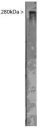 Anti-MAP2 antibody used in Western Blot (WB). GTX30663