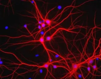 Anti-MAP2 antibody used in Immunocytochemistry/ Immunofluorescence (ICC/IF). GTX30663