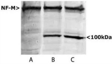 Anti-NF-M antibody used in Western Blot (WB). GTX30667