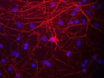 Anti-NF-M antibody used in Immunocytochemistry/ Immunofluorescence (ICC/IF). GTX30667
