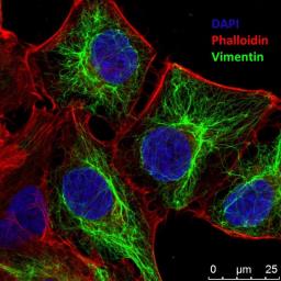 Anti-Vimentin antibody used in Immunocytochemistry/ Immunofluorescence (ICC/IF). GTX30668