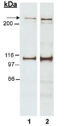 Anti-Nestin antibody used in Western Blot (WB). GTX30670