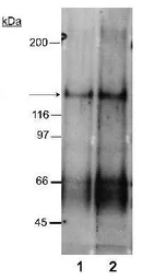 Anti-NPC1L1 antibody used in Western Blot (WB). GTX30675
