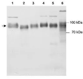 Anti-LIMP II antibody used in Western Blot (WB). GTX30676