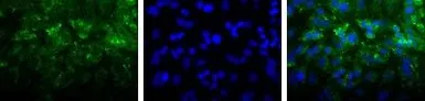 Anti-LIMP II antibody used in Immunocytochemistry/ Immunofluorescence (ICC/IF). GTX30676