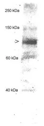 Anti-ChREBP antibody used in Western Blot (WB). GTX30677