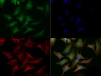 Anti-ChREBP antibody used in Immunocytochemistry/ Immunofluorescence (ICC/IF). GTX30677