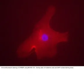 Anti-ChREBP antibody used in Immunocytochemistry/ Immunofluorescence (ICC/IF). GTX30677