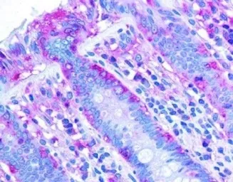 Anti-ChREBP antibody used in IHC (Paraffin sections) (IHC-P). GTX30677