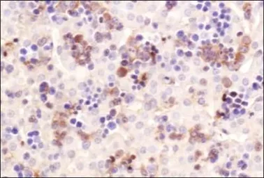 Anti-ChREBP antibody used in IHC (Paraffin sections) (IHC-P). GTX30677