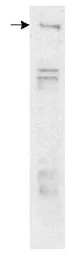 Anti-LRRK2 antibody used in Western Blot (WB). GTX30678