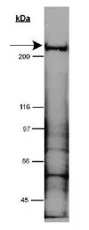Anti-LRRK2 antibody used in Western Blot (WB). GTX30678