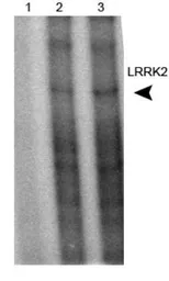 Anti-LRRK2 antibody used in Immunoprecipitation (IP). GTX30678