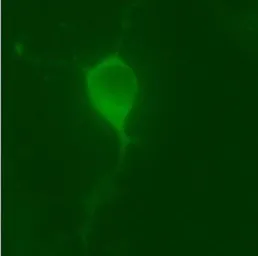 Anti-LRRK2 antibody used in Immunocytochemistry/ Immunofluorescence (ICC/IF). GTX30678