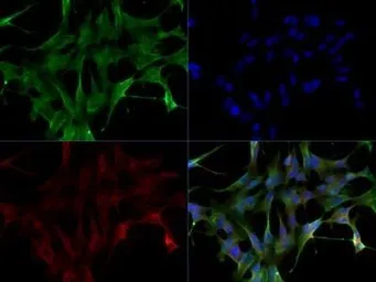 Anti-LRRK2 antibody used in Immunocytochemistry/ Immunofluorescence (ICC/IF). GTX30678