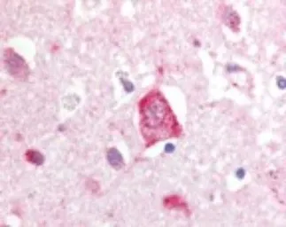 Anti-LRRK2 antibody used in IHC (Paraffin sections) (IHC-P). GTX30678