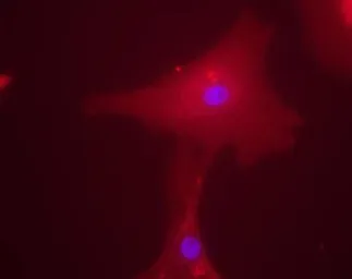 Anti-ChREBP antibody used in Immunocytochemistry/ Immunofluorescence (ICC/IF). GTX30679