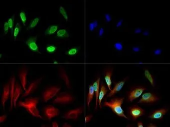 Anti-NuMA antibody used in Immunocytochemistry/ Immunofluorescence (ICC/IF). GTX30688