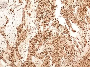 Anti-NuMA antibody used in IHC (Paraffin sections) (IHC-P). GTX30688