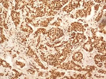 Anti-NuMA antibody used in IHC (Paraffin sections) (IHC-P). GTX30688