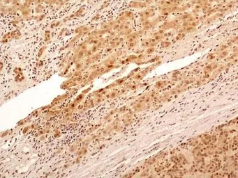 Anti-NuMA antibody used in IHC (Paraffin sections) (IHC-P). GTX30688