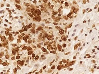 Anti-NuMA antibody used in IHC (Paraffin sections) (IHC-P). GTX30688