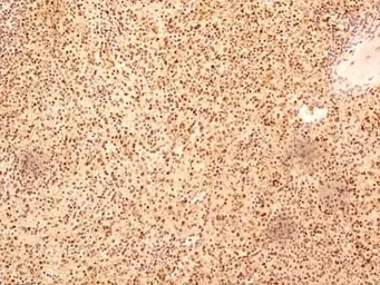 Anti-NuMA antibody used in IHC (Paraffin sections) (IHC-P). GTX30688