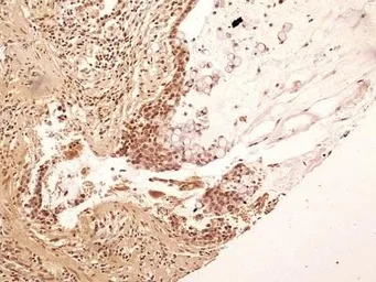 Anti-NuMA antibody used in IHC (Paraffin sections) (IHC-P). GTX30688