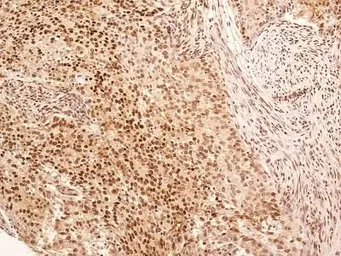 Anti-NuMA antibody used in IHC (Paraffin sections) (IHC-P). GTX30688