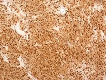 Anti-NuMA antibody used in IHC (Paraffin sections) (IHC-P). GTX30688