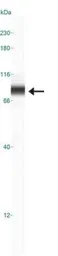 Anti-NUMB antibody used in Western Blot (WB). GTX30689