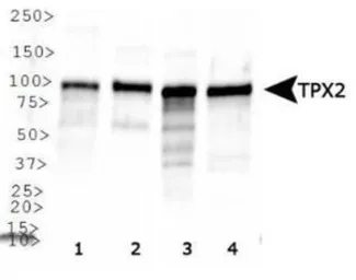 Anti-TPX2 antibody used in Western Blot (WB). GTX30690