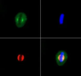 Anti-KIF2A antibody used in Immunocytochemistry/ Immunofluorescence (ICC/IF). GTX30691