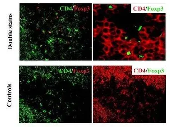 Anti-FOXP3 antibody used in Immunohistochemistry (IHC). GTX30696