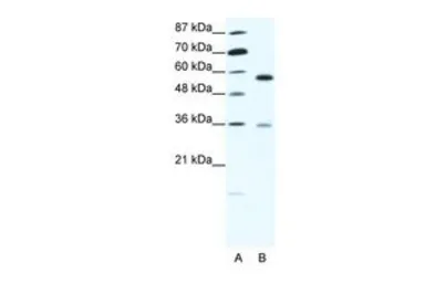 Anti-GDI1 antibody, C-term used in Western Blot (WB). GTX30781