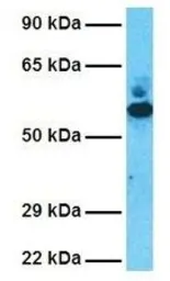 Anti-GDI2 antibody, C-term used in Western Blot (WB). GTX30782
