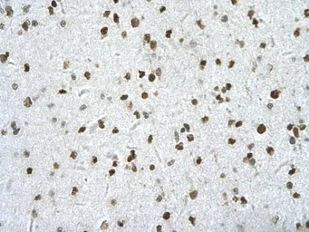 Anti-HIPK2 antibody, Internal used in IHC (Paraffin sections) (IHC-P). GTX30803