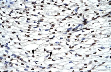 Anti-HIPK2 antibody, Internal used in IHC (Paraffin sections) (IHC-P). GTX30803