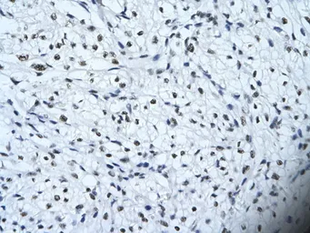 Anti-HIPK2 antibody, Internal used in IHC (Paraffin sections) (IHC-P). GTX30803