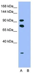 Anti-HIPK2 antibody, Internal used in Western Blot (WB). GTX30803