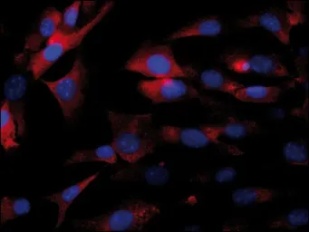 Anti-EIF2B epsilon antibody used in Immunocytochemistry/ Immunofluorescence (ICC/IF). GTX30808