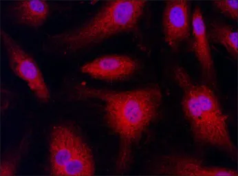 Anti-TYK2 antibody used in Immunocytochemistry/ Immunofluorescence (ICC/IF). GTX30812