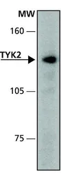 Anti-TYK2 antibody used in Western Blot (WB). GTX30812