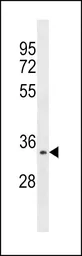 Anti-Aurora C antibody used in Western Blot (WB). GTX30859
