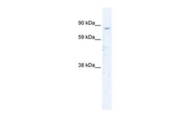 Anti-SIRT1 antibody, N-term used in Western Blot (WB). GTX30870